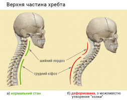 Верхня частина хребта