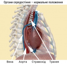 Органи середостіння